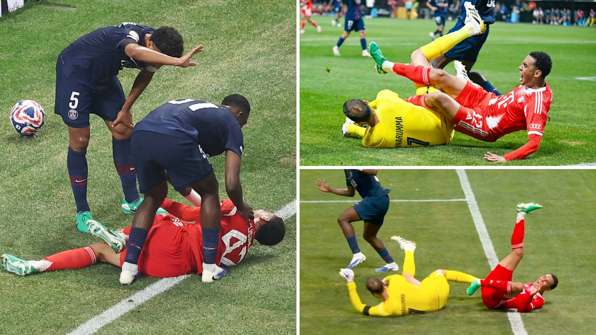 世界杯明星选手受伤退赛，引发热议